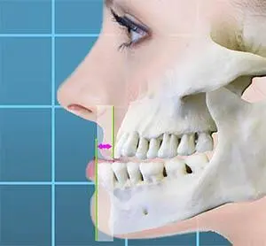 Kurpis Center For Implant & Cosmetic Dentistry