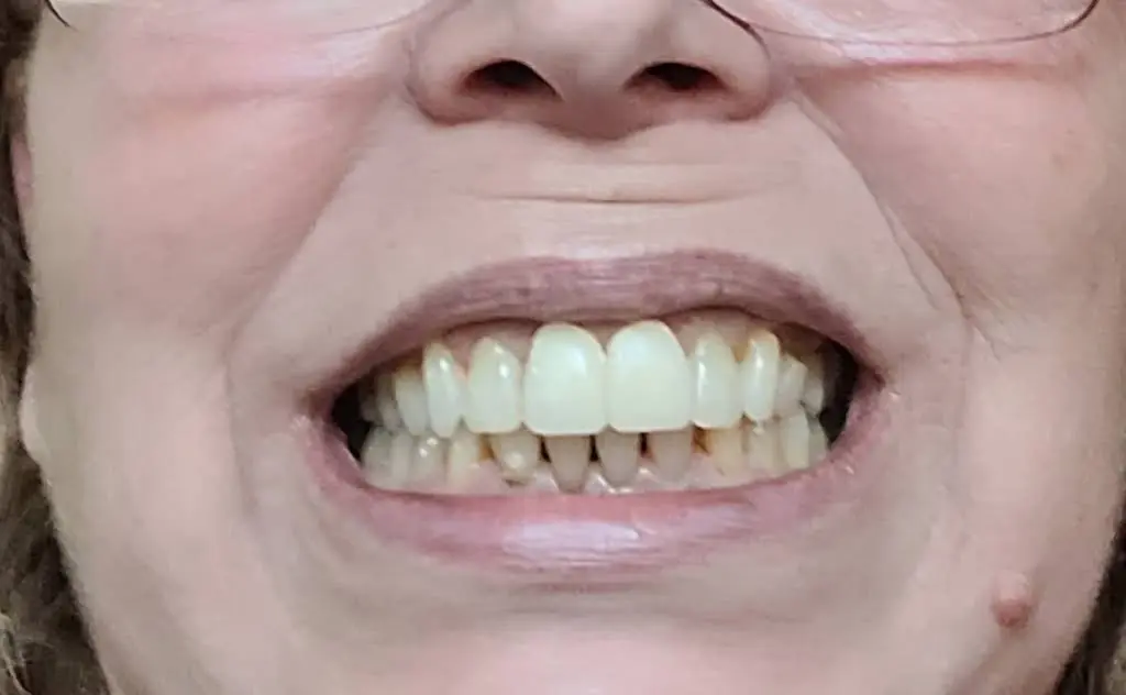 Kurpis Center For Implant & Cosmetic Dentistry