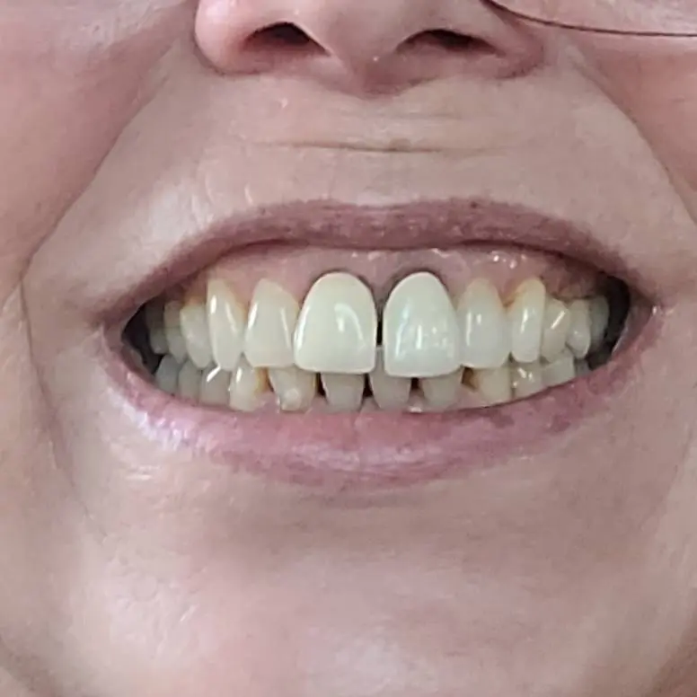 Kurpis Center For Implant & Cosmetic Dentistry