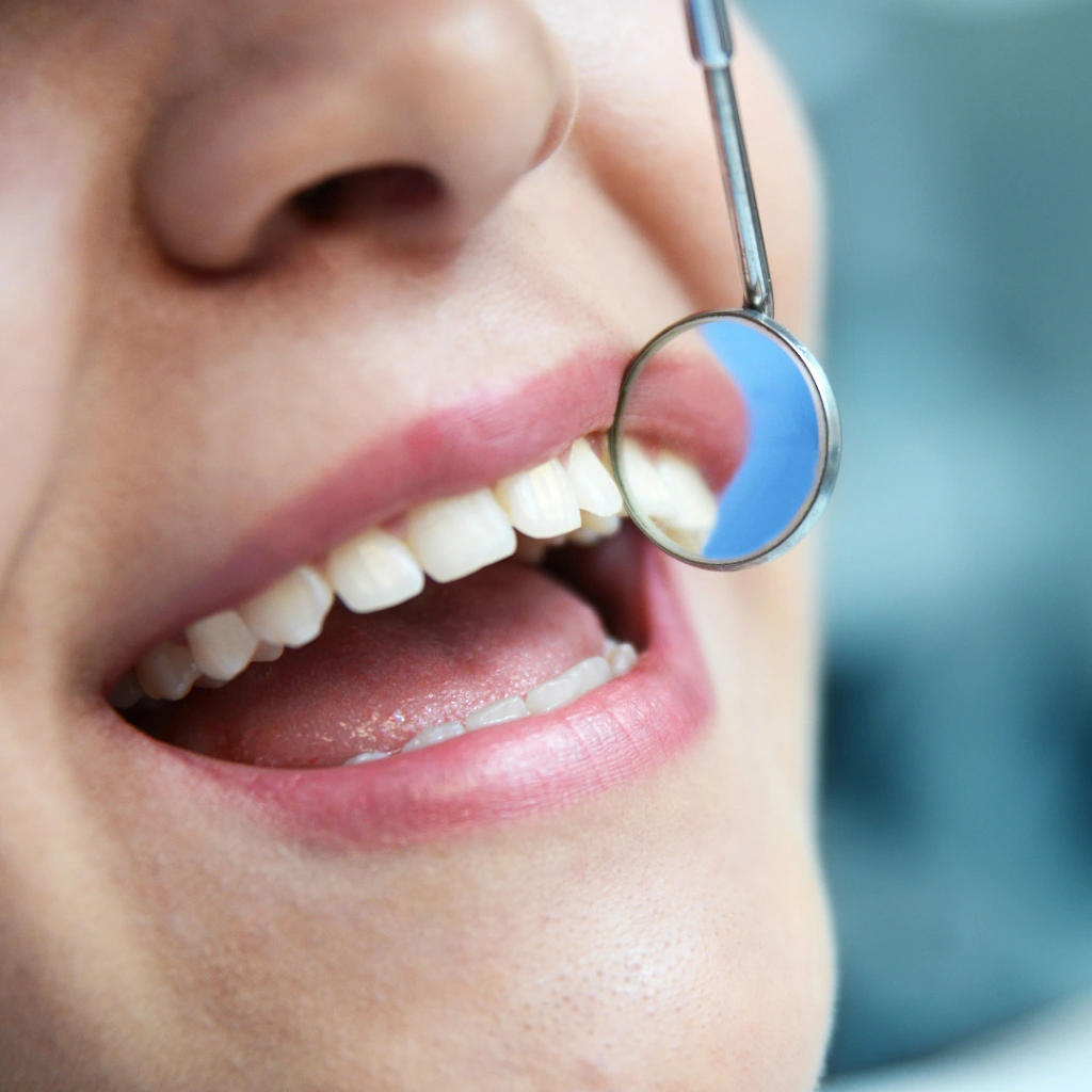 My Smile Dental