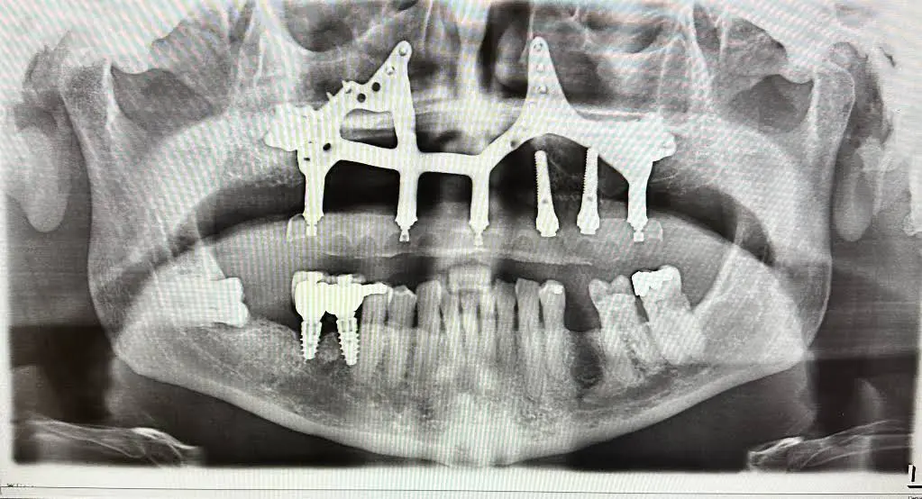 Apollonia Dental Arts