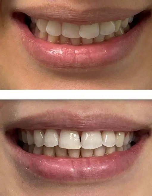 Eatontown Dental Care