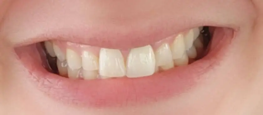 Eatontown Dental Care