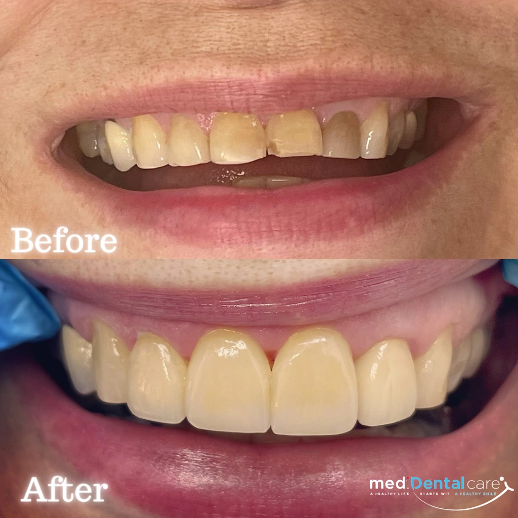 MediDental Care
