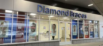 Diamond Braces