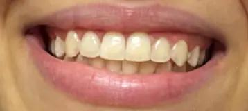 Richmond Avenue Orthodontics