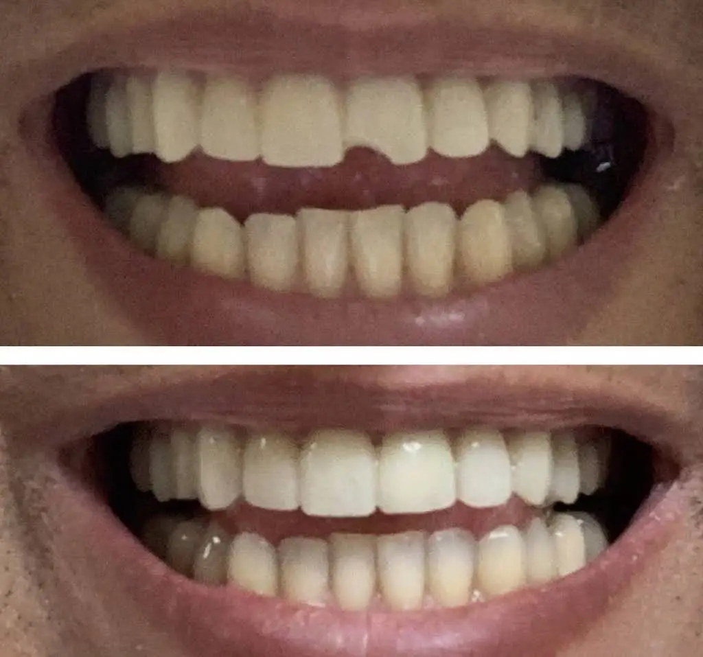 Feiler Dental Associates