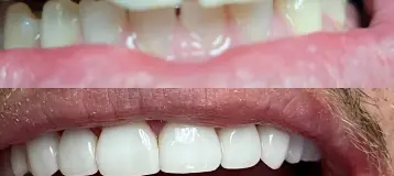 Louisa Correa DDS
