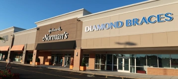 Diamond Braces