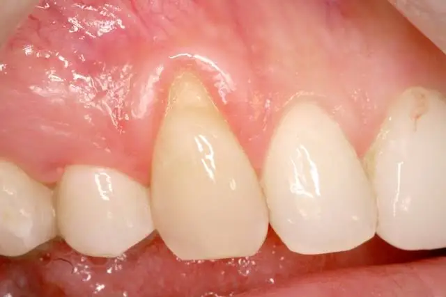 Progressive Periodontics and Implant Dentistry