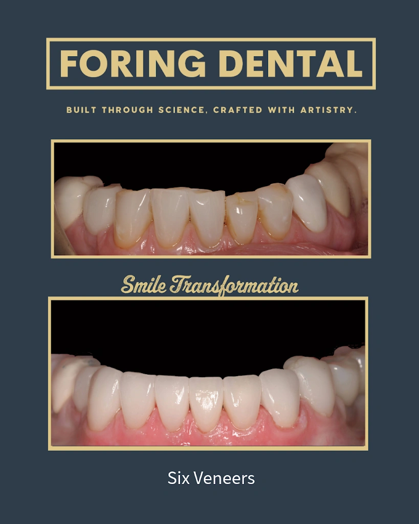 Foring Dental