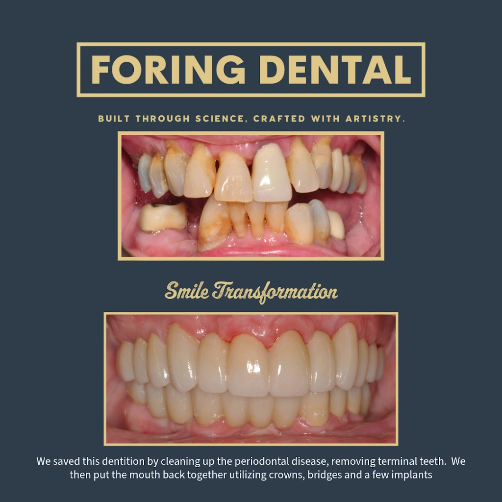 Foring Dental