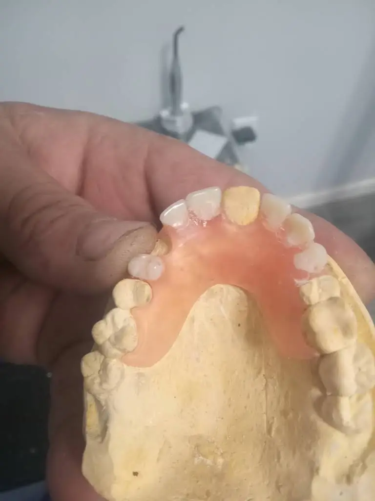 Economica Dental Dentauras y Extracciones