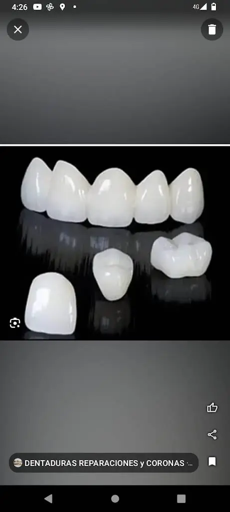 Economica Dental Dentauras y Extracciones