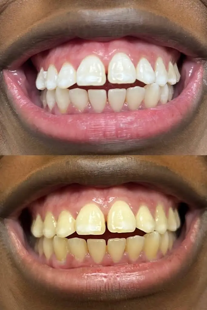 Premier Dental