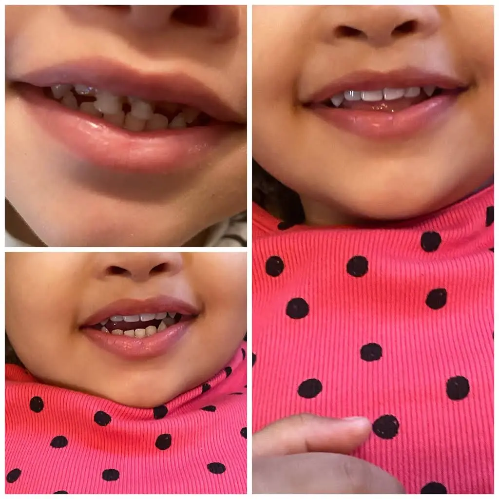 Dr. Denise Cohen - Pediatric Dentistry