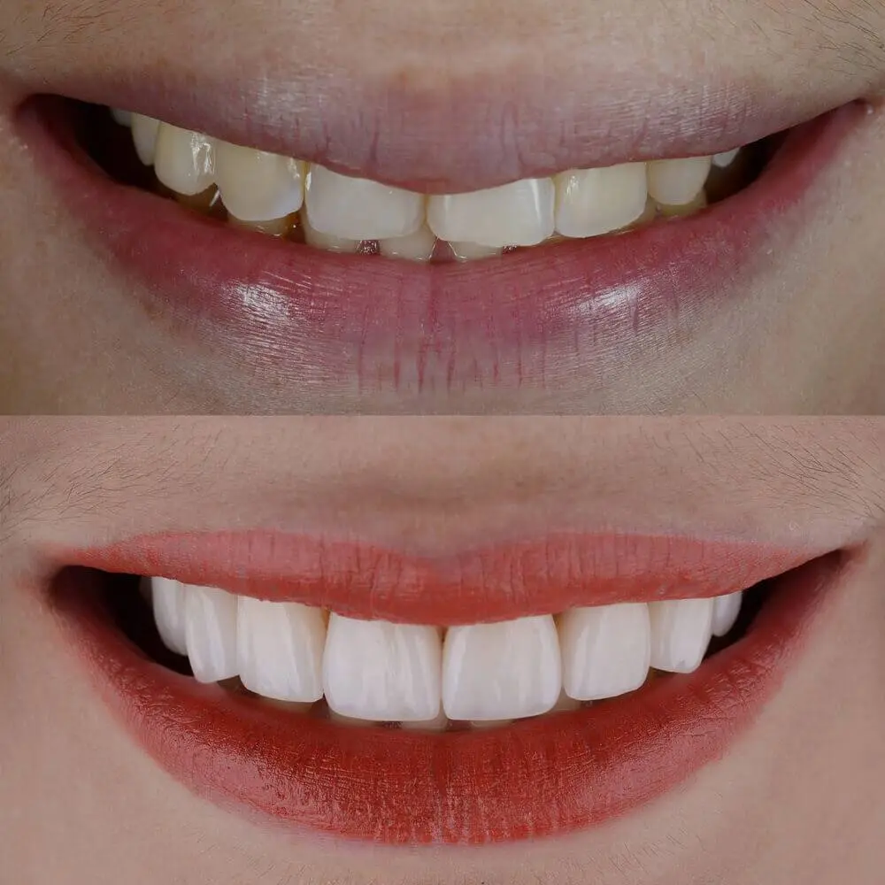 Family Smiles & Dental Implant Center