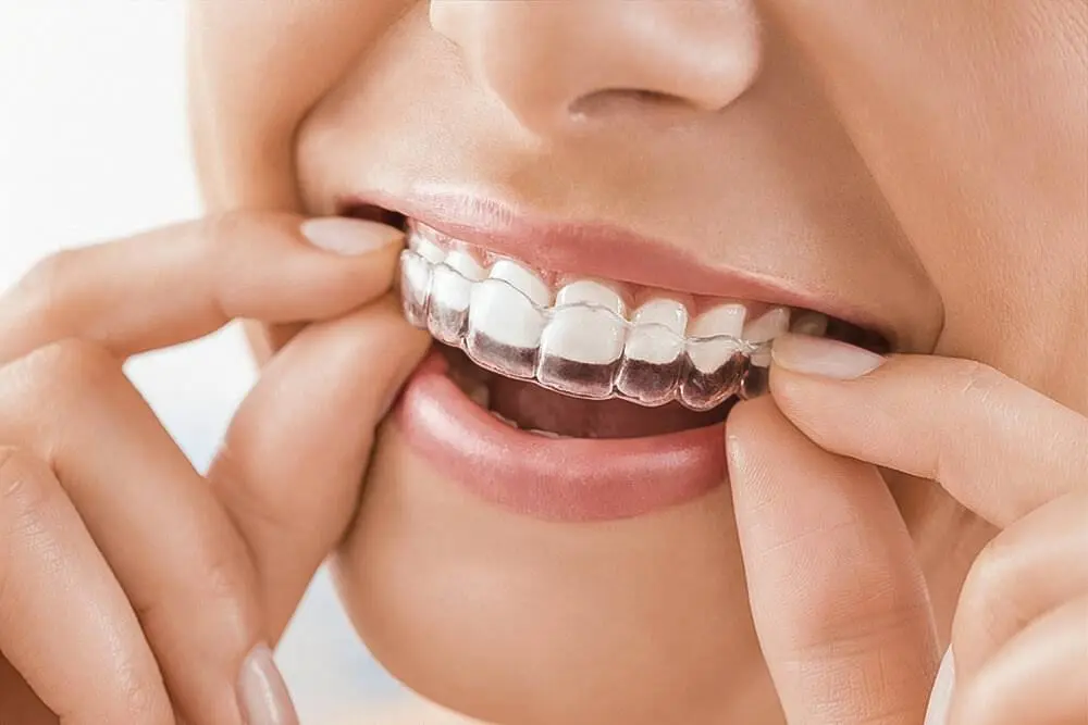 Family Smiles & Dental Implant Center