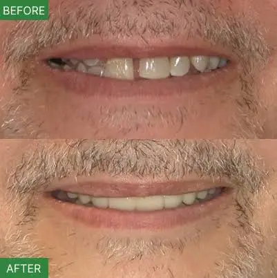NJ Implant Dentist – Dr. Arnold Do