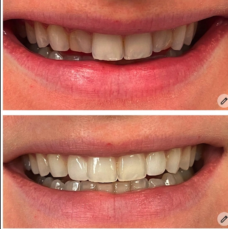 Malki Dental