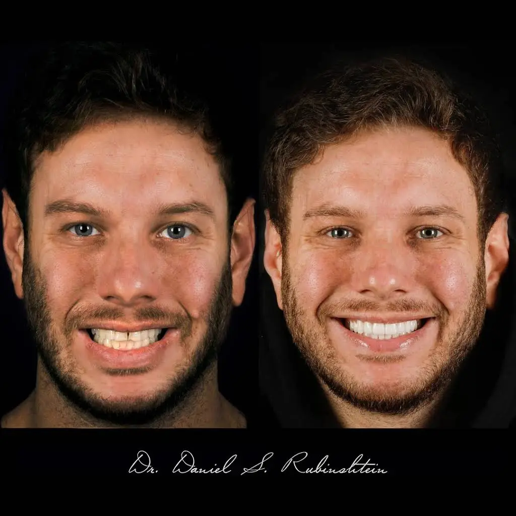 Aesthetic and Laser Dentistry of New York