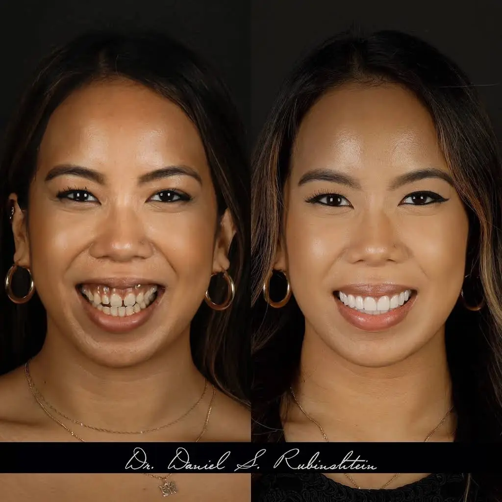 Aesthetic and Laser Dentistry of New York