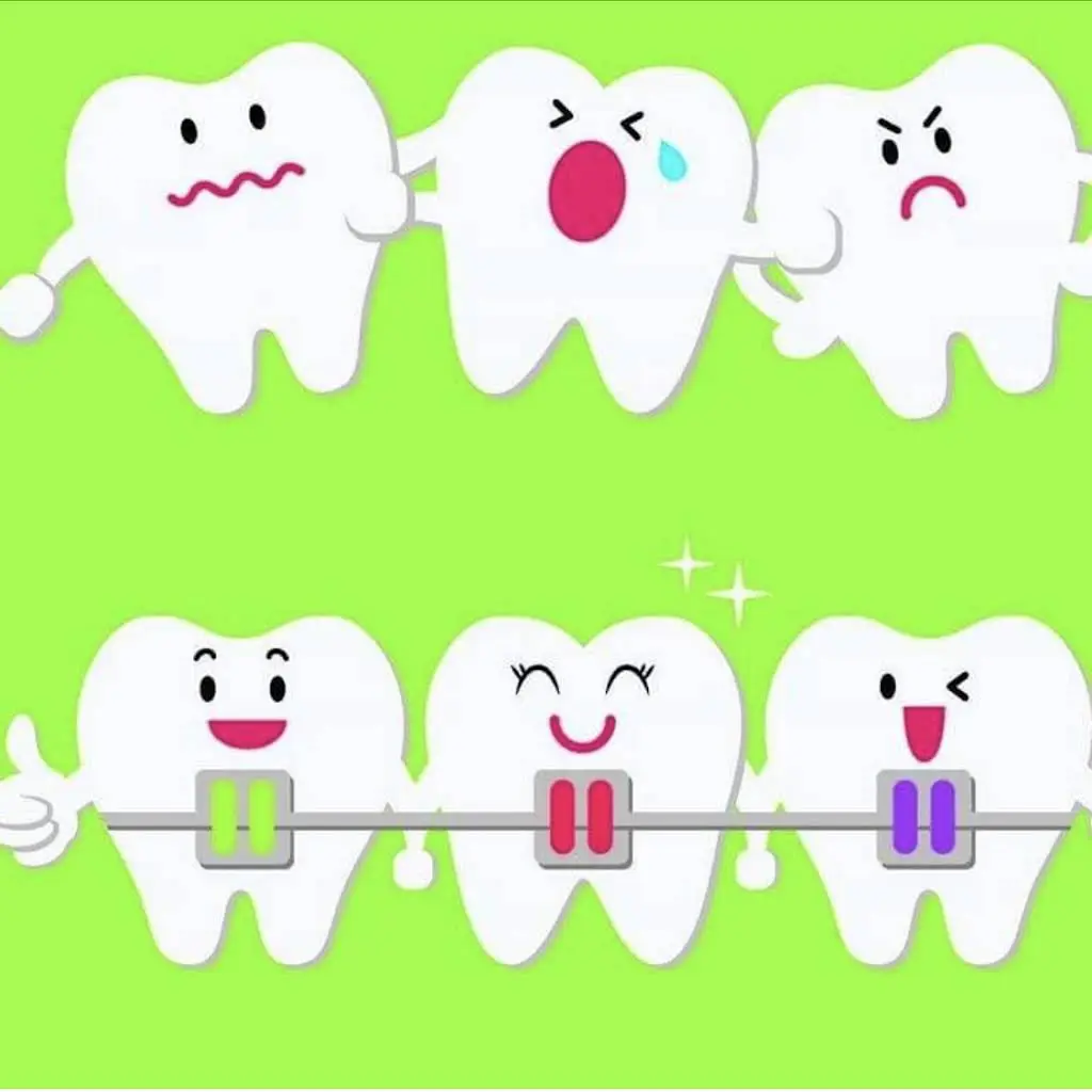 Straight Smiles Orthodontics