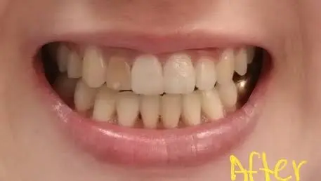 Prima Smile Dental : Daisy Song DDS