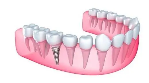 Dr Naser Sharifi Implant Dentistry - Professional dental clinic exterior with modern facilities