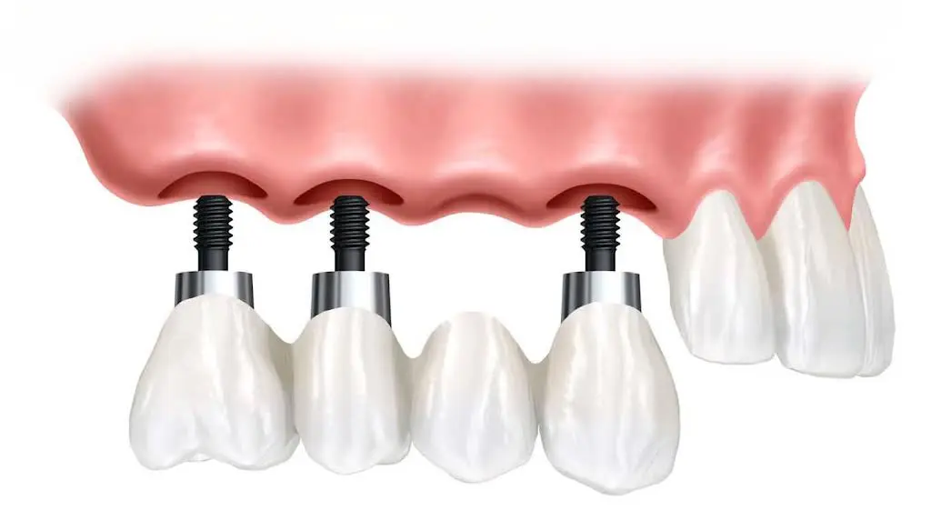Glen Oaks Dental Professionals