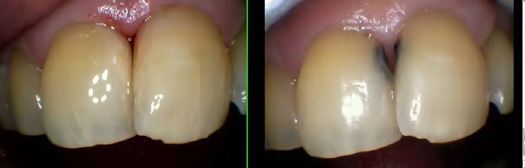 Pandya Dental Care