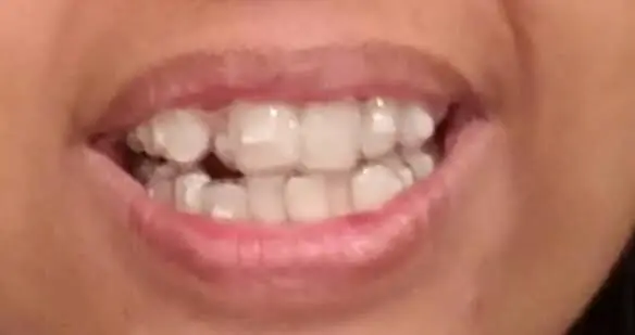 Pandya Dental Care