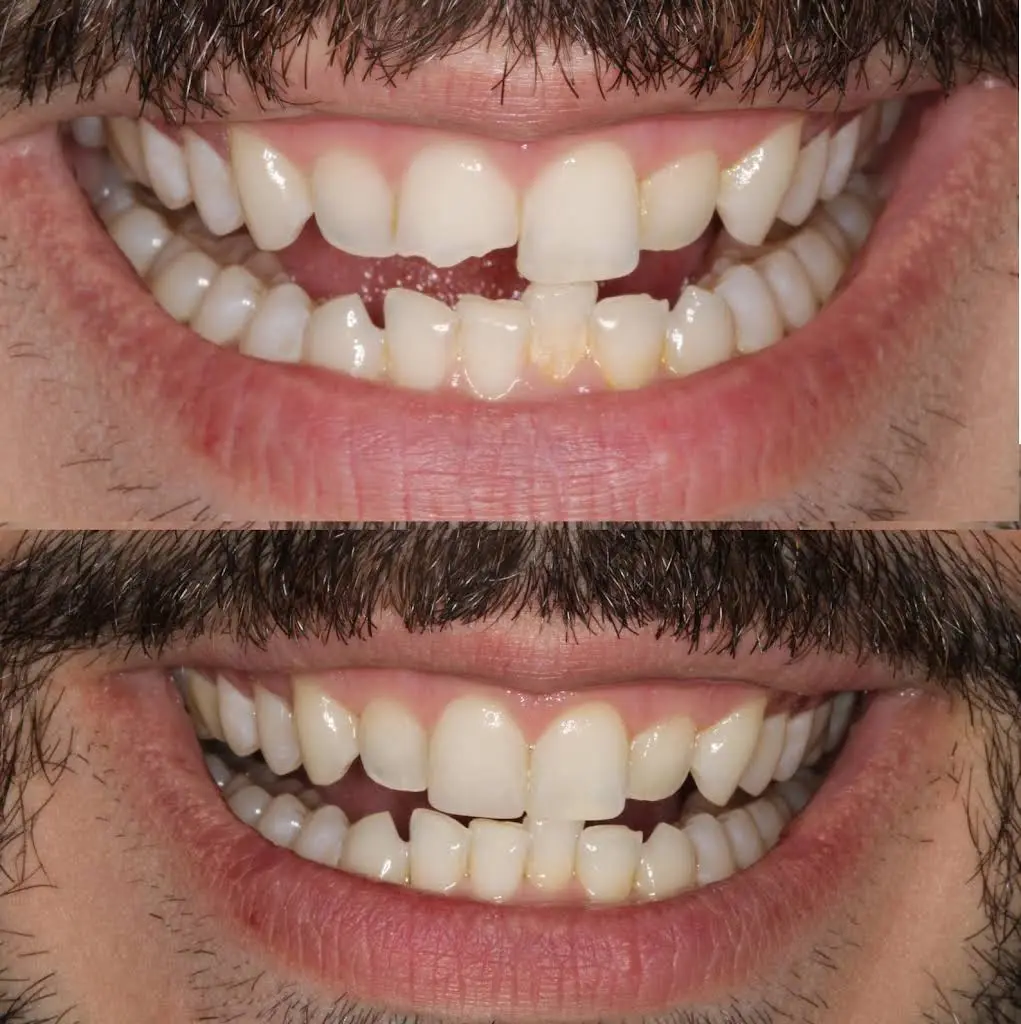 Perfect Smile Dental Arts