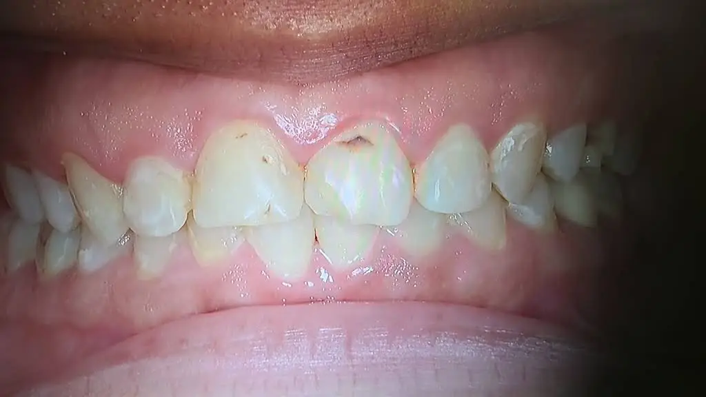 Center for Smiles