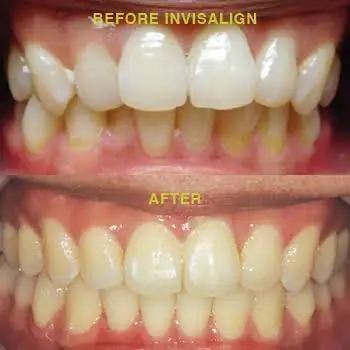 Yen Dentistry and Implantology
