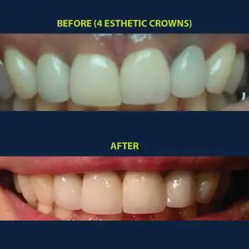 Yen Dentistry and Implantology