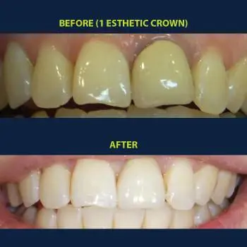 Yen Dentistry and Implantology