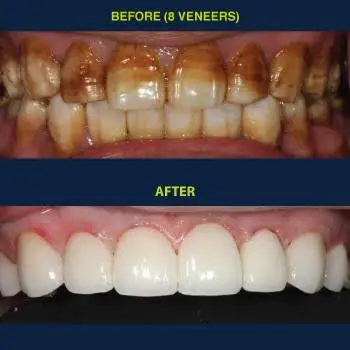 Yen Dentistry and Implantology