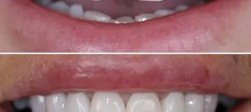 Enhance Dentistry