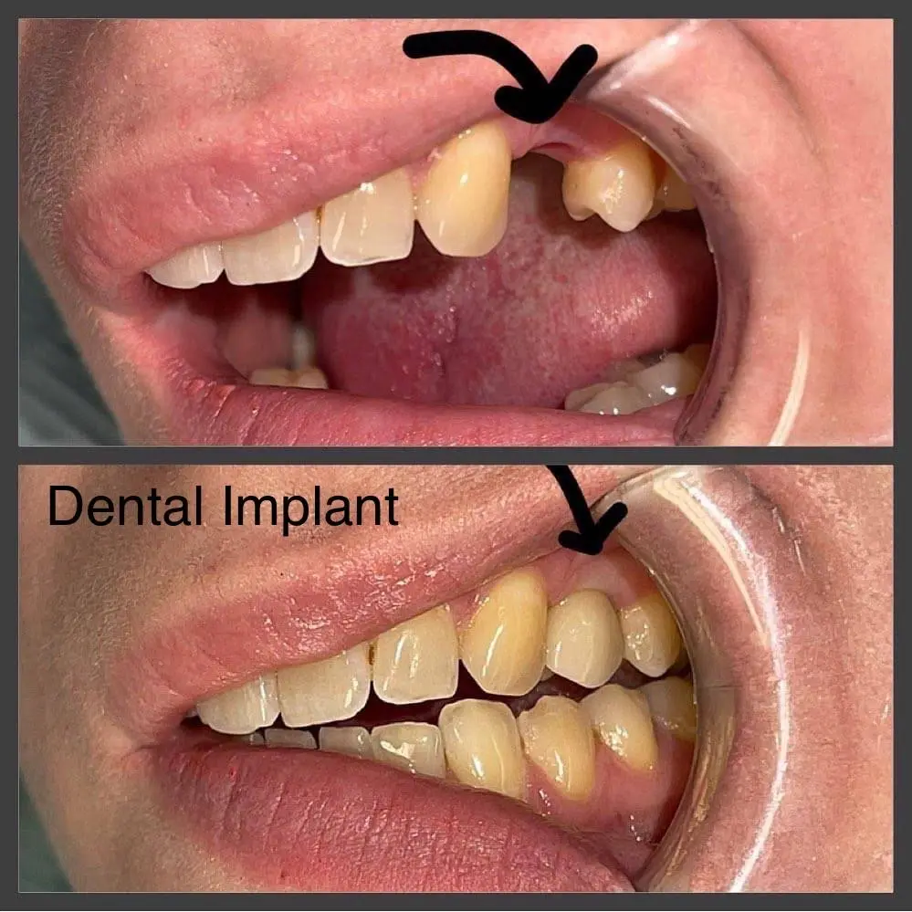 Smiles by Bergen Dental Emerson
