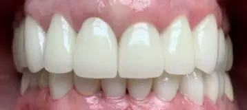 Anna Ellerin DDS