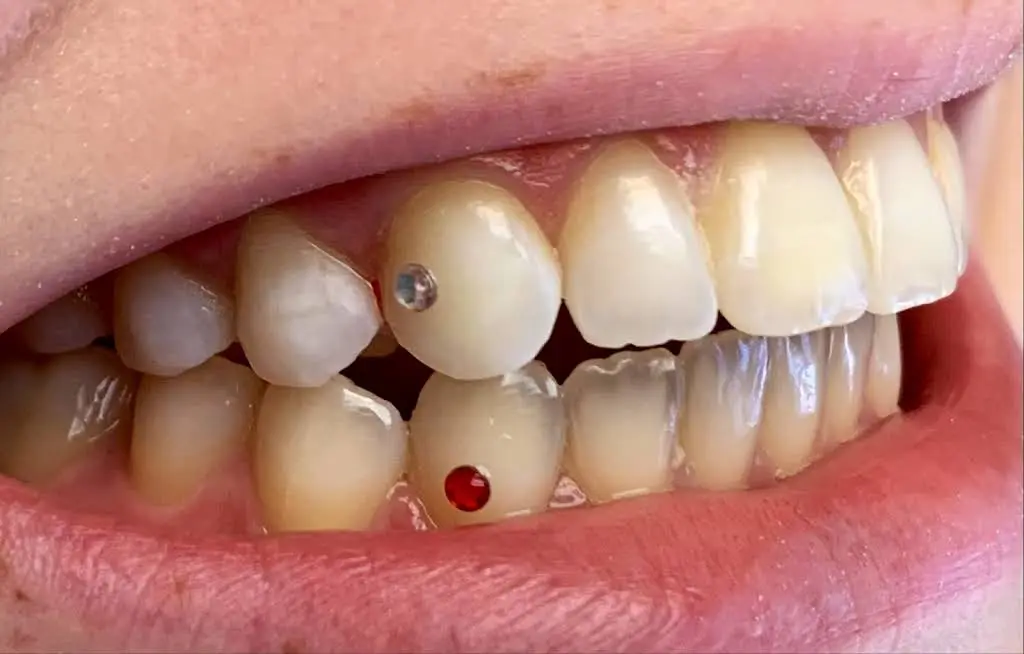 Anna Ellerin DDS