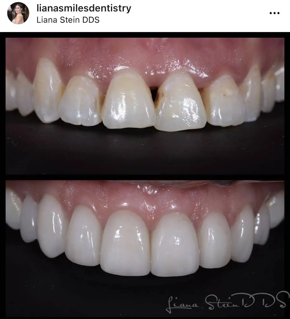 LianaSmiles: Liana Stein, DDS