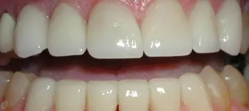 Bergenfield Dental