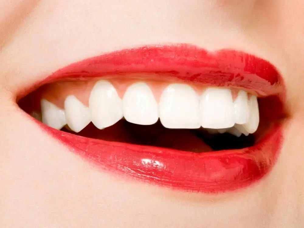 Bergenfield Dental
