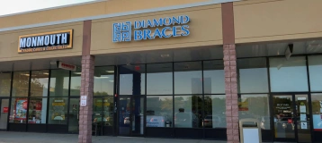 Diamond Braces