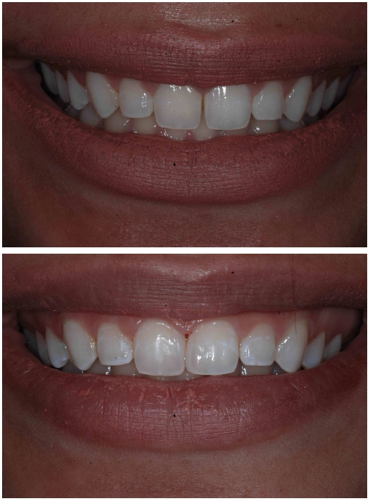 Spring Lake Dental Care