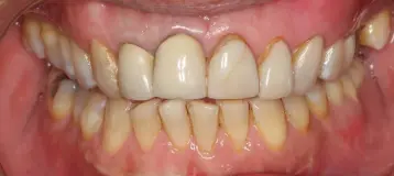 L & L Dental Associates