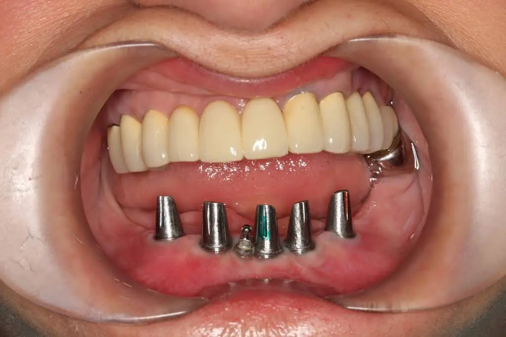 L & L Dental Associates