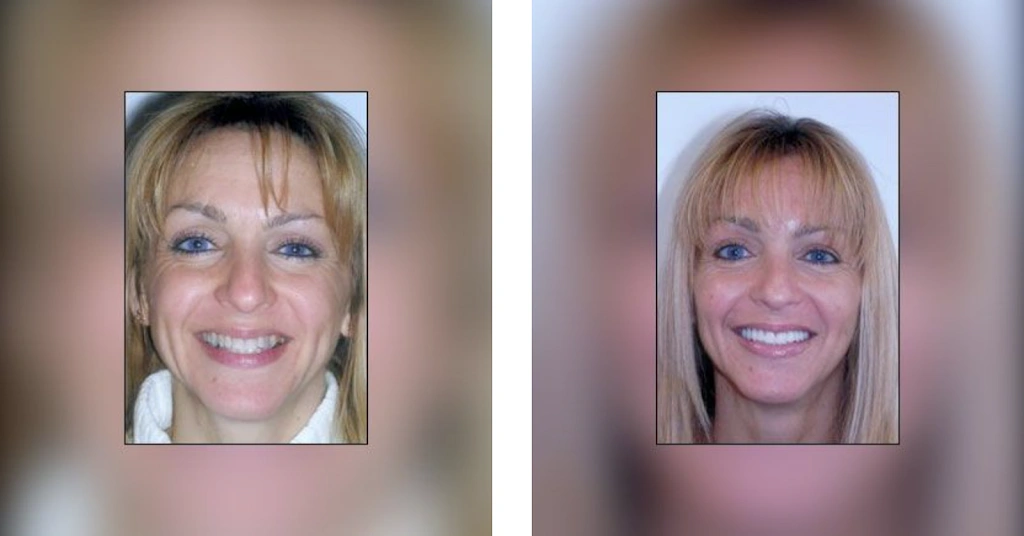 Garden City Smiles: Louis J. Buono, DDS